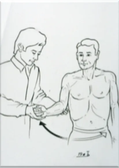 Limited mobility in external rotation