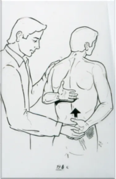 Limited mobility in internal rotation
